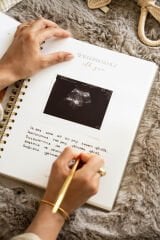 Matt Notebook Bebek Anı Defteri ve Anne Hamile Günlüğü Fotoğraf Albümü